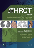 肺HRCT 原書5版
