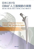 日本におけるCORAIL®人工股関節の実際